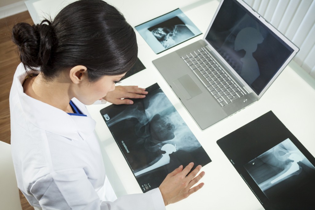 Doctor Hip X Rays - iStock_000021247551_Medium